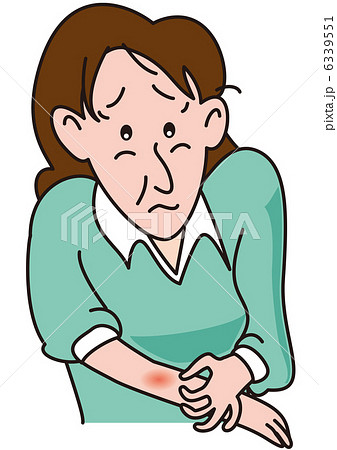 内出血 虫さされの写真素材