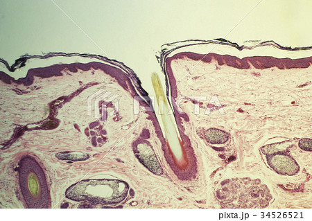 上 毛根 顕微鏡 髭 毛根 顕微鏡