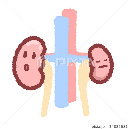 腎萎縮のイラスト素材 腎萎縮のイラスト素材
