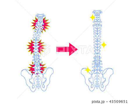 脊椎 骨格 脊柱 背骨のイラスト素材