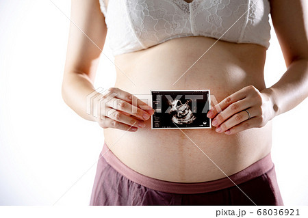 エコー ベビー 胎児 女の子の写真素材 エコー ベビー 胎児 女の子の写真素材