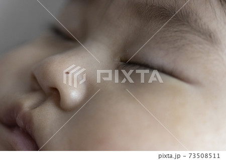 ひっかきキズの写真素材