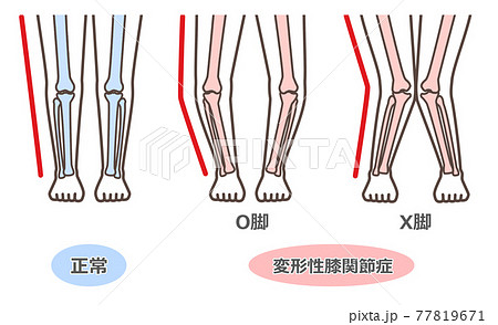 足 脚 のイラスト素材集 ピクスタ