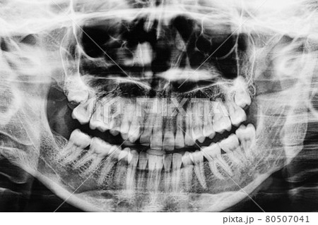 デンタル 歯科 骨格 X線の写真素材 - PIXTA